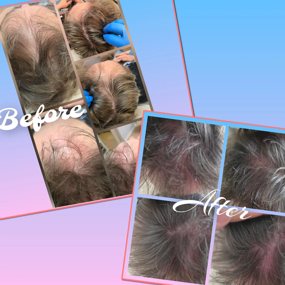 Before-and-after collage from an individual hair and scalp treatment